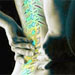 Prolapse Pelvic Support